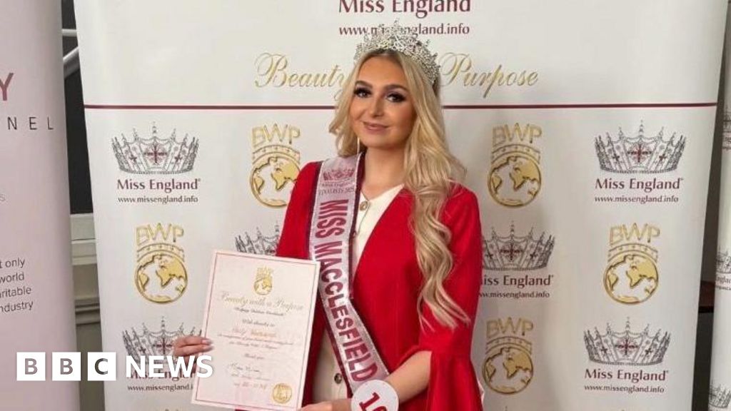 Macclesfield beauty queen finds tumour at routine eye test