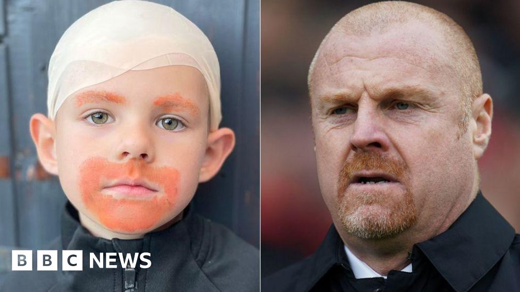 Boy, 5, comes to school fancy dress day as Sean Dyche