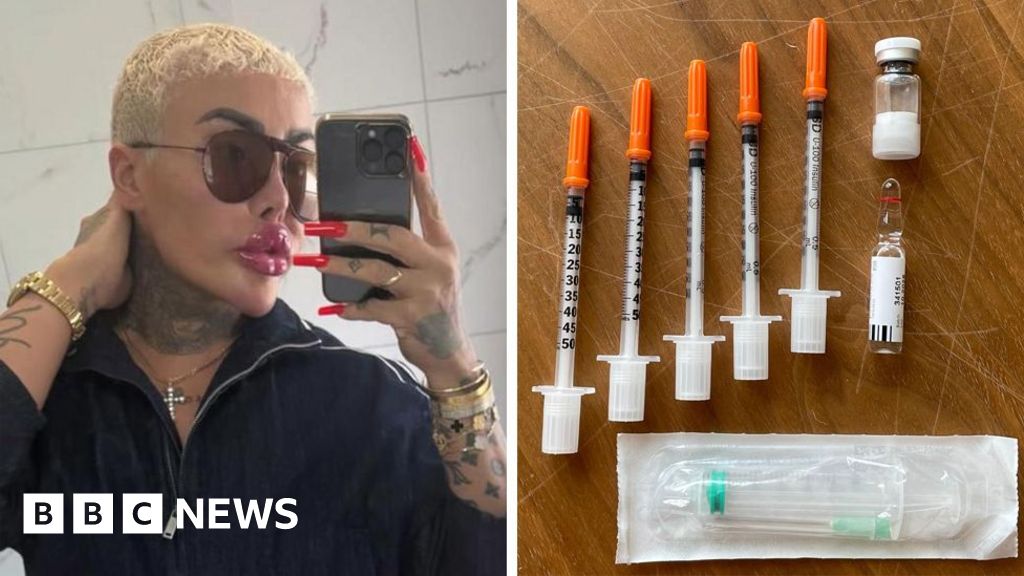 We're furious the 'Lip King' is selling weight-loss jabs, say dead mother's family