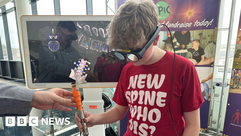 Stoke-on-Trent Hospital Pioneers UK’s First VR Spine Surgery Stoke-on-Trent Hospital Pioneers UK’s First VR Spine Surgery