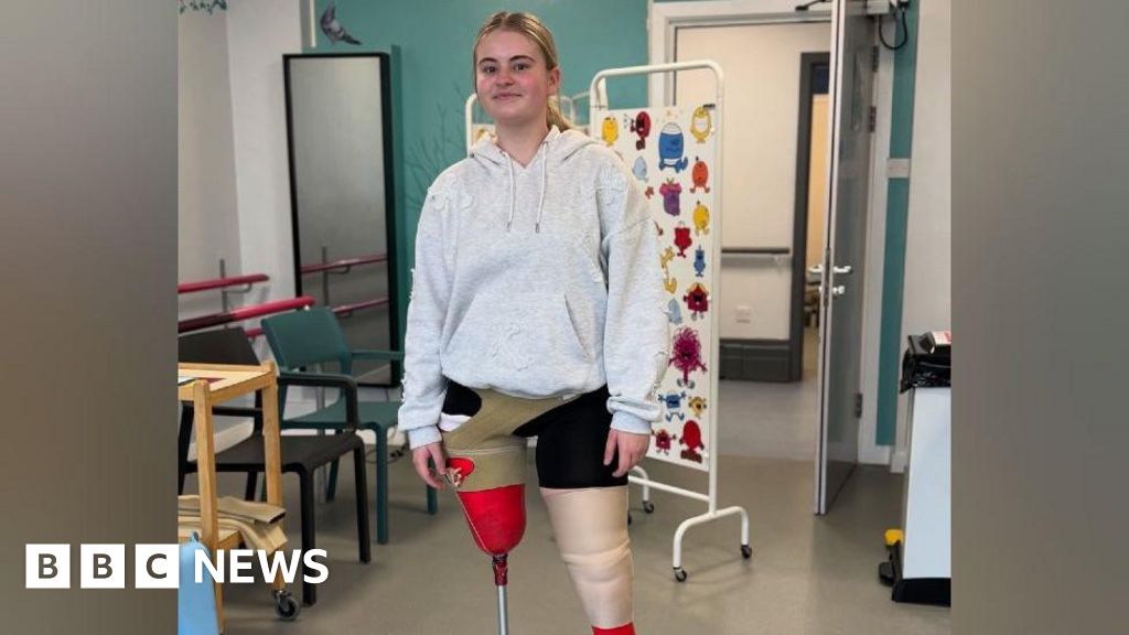 'I want to inspire other amputees to chase dreams'
