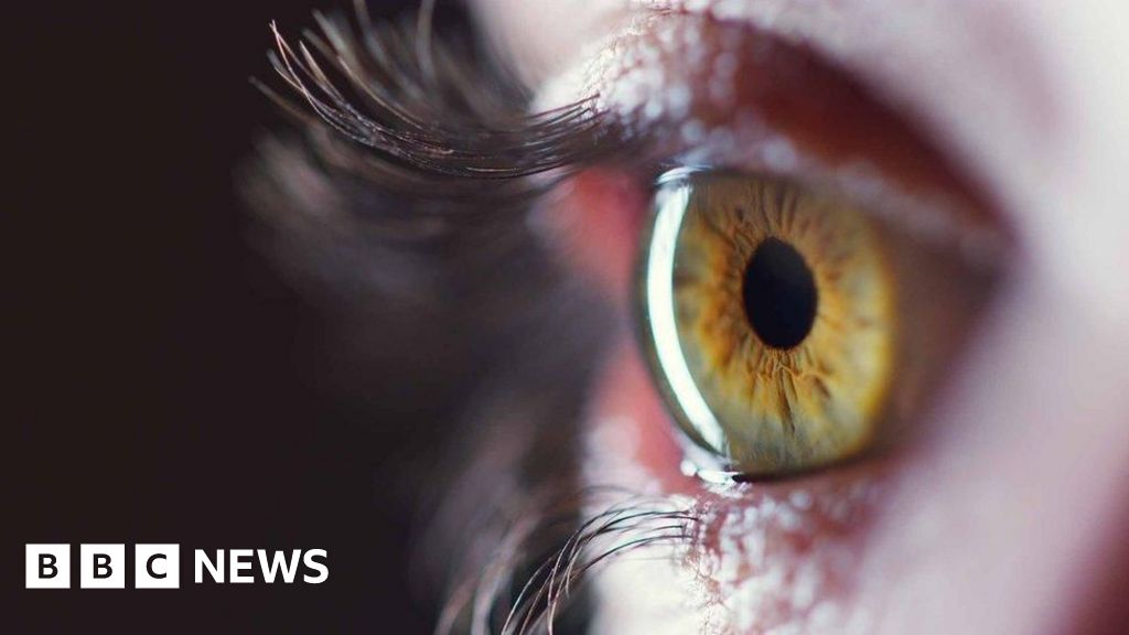 Sister's cornea gift sparks appeal for more donors