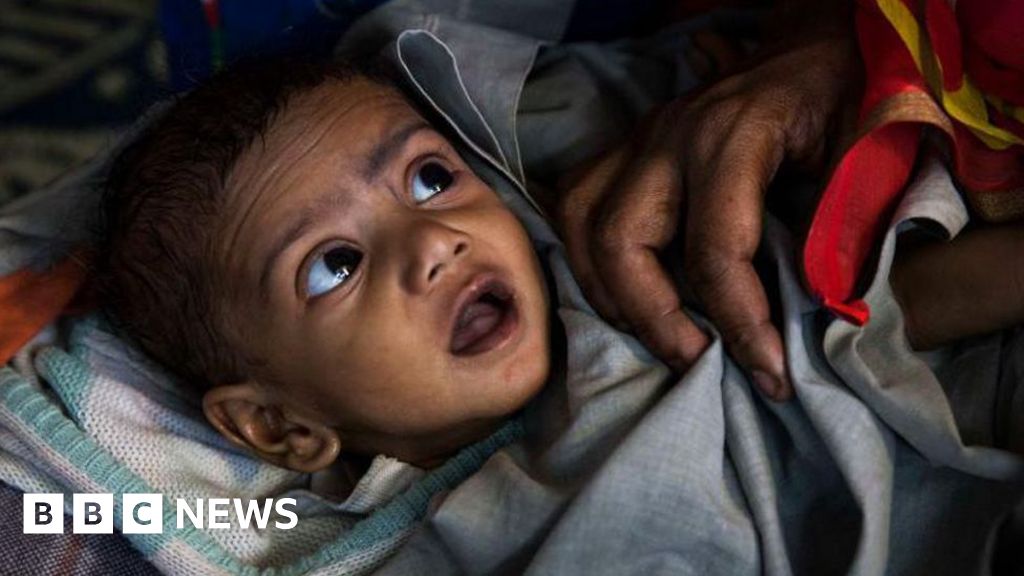 The missing puzzle piece in India’s child stunting crisis