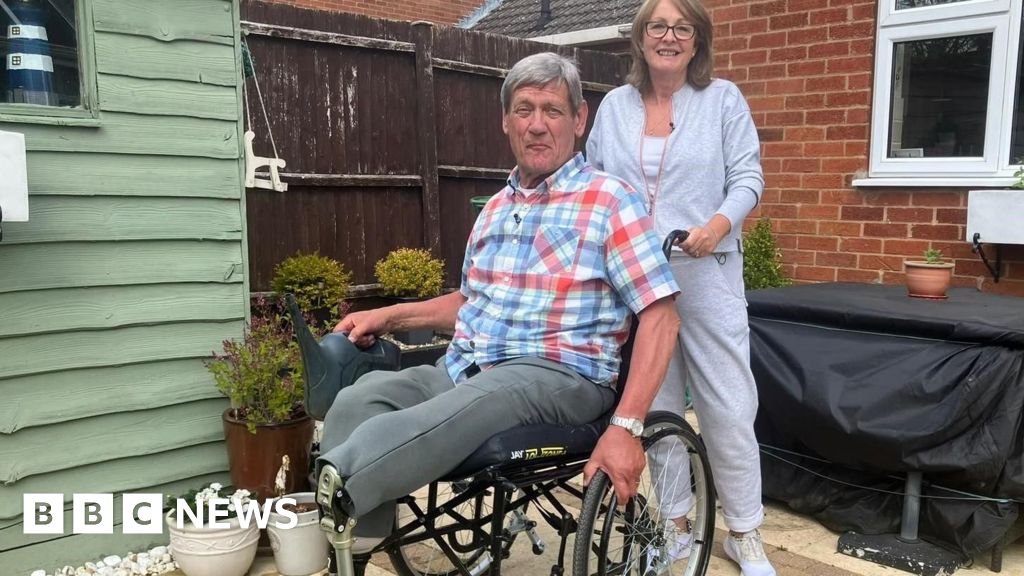 'Not enough is known about condition that led to my leg amputations'