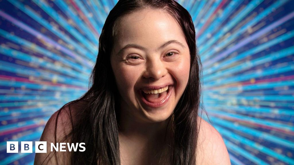 Model and actress Ellie Goldstein joins Strictly line-up