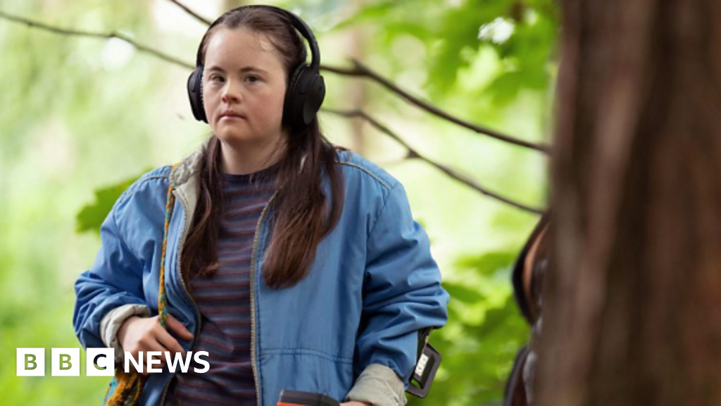 Actress aims to break Down's syndrome barriers