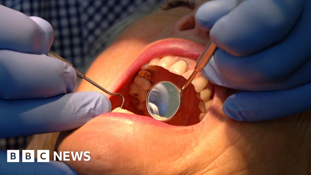 Oral cancer fears due to NHS dentist shortage