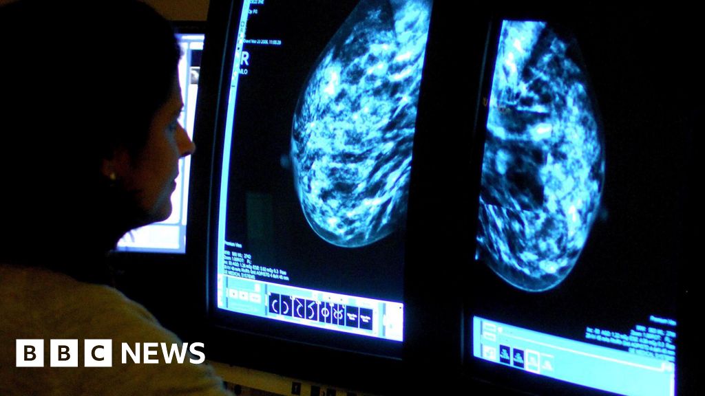 £1M Funding Boost for Breast Cancer Recurrence Research in Sheffield