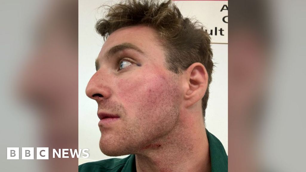 Police volunteer attacked after stopping pickpocket