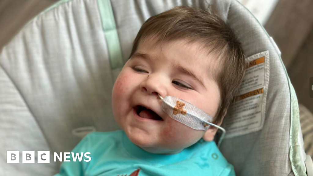 'Our son is one of 16 kids with this condition. He might not live to Christmas'
