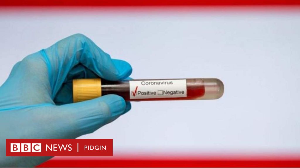 Coronavirus: Covid-19 test samples miss afta Jaguda pipo 'thief ...