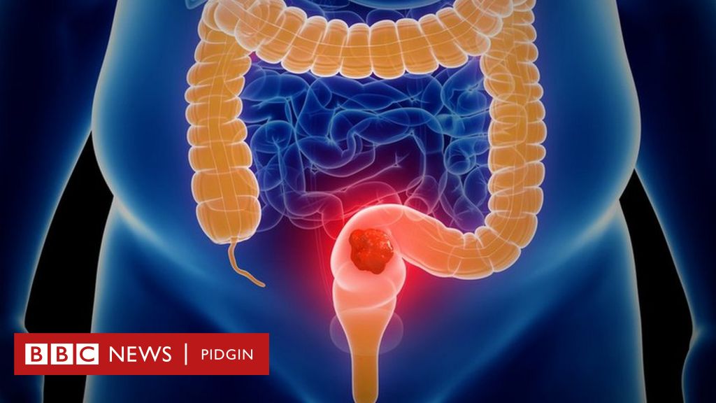 New organ named in digestive system - BBC News