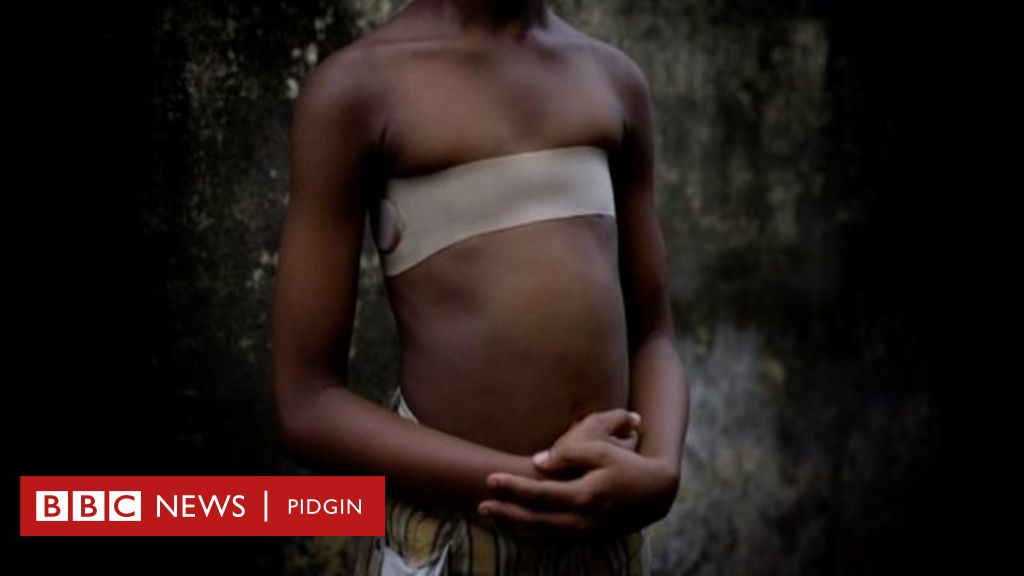 Massage Forced Sex - Breast ironing: 'Schools suppose dey teach am by force' - BBC News Pidgin