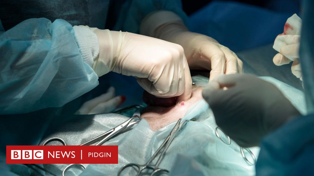 Brazil hospital sack doctor ontop accuse say e orally rape woman during  C-section - BBC News Pidgin