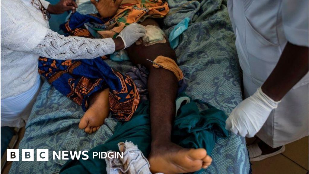 Hospitals no need police report to treat gunshot wounds IGP BBC