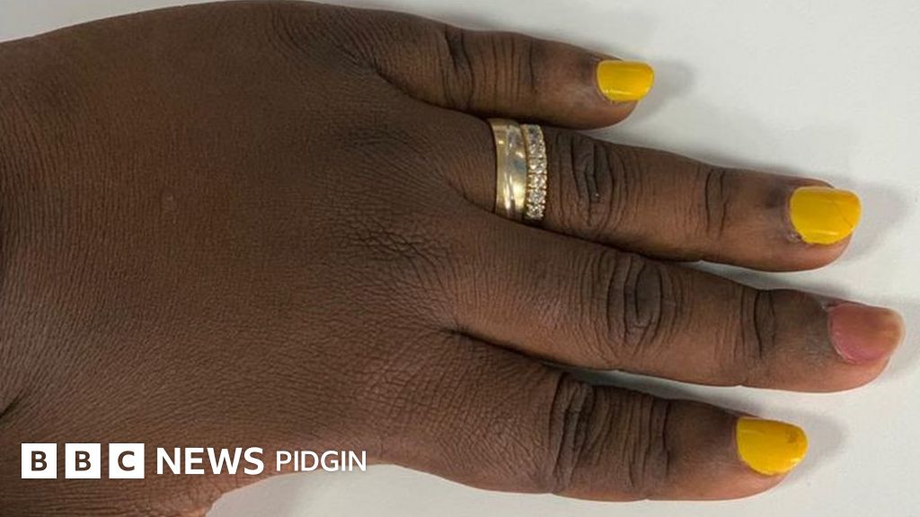 Bad dream make woman swallow her engagement ring BBC News Pidgin