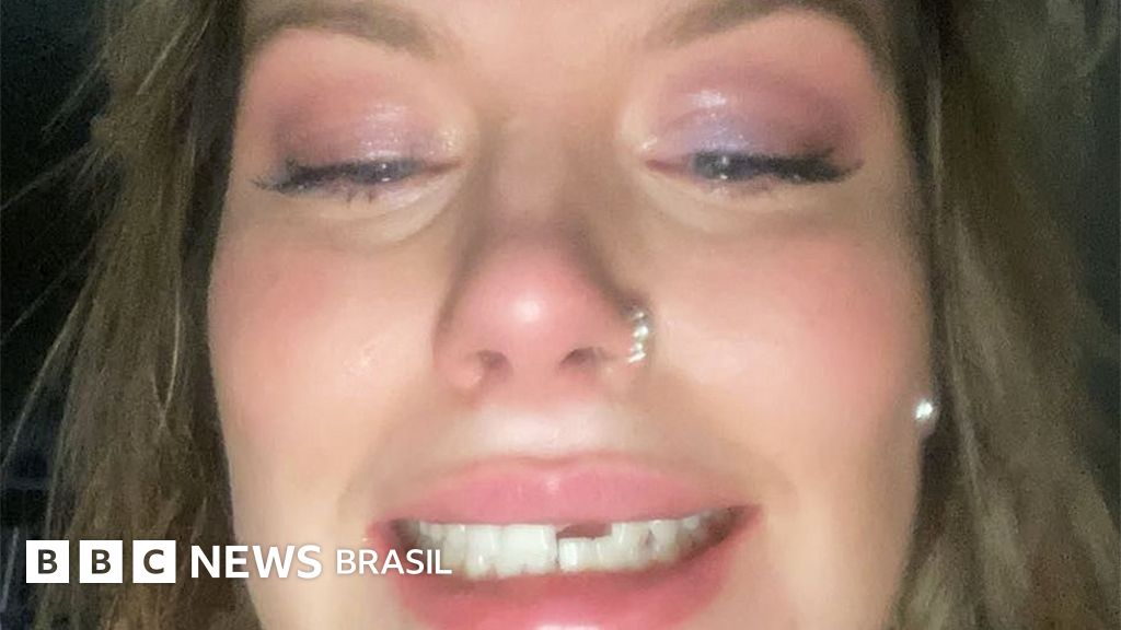 ‘Por que compartilhei na internet fotos da agressão que sofri’