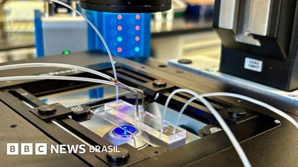 Encontrando 'espermatozoides ocultos': a técnica de IA que tem dado esperança a homens antes considerados inférteis