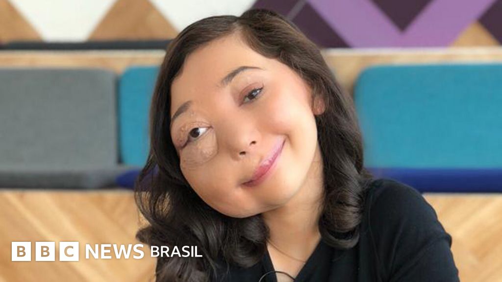 Nikki Lilly, a youtuber com malformação no rosto que será premiada pelo Bafta: 'Já sou imune a me chamarem de feia'
