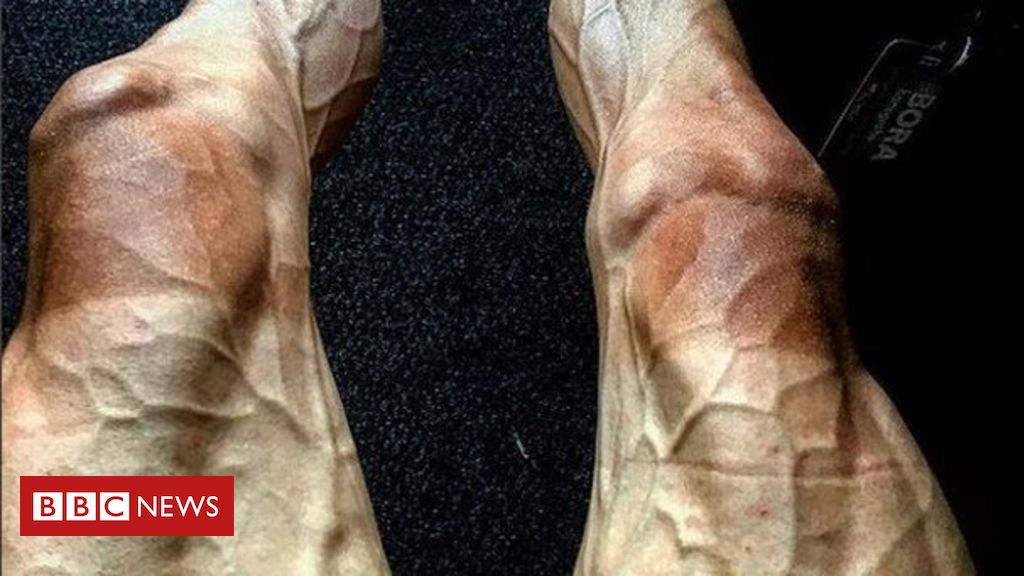 La belle photo qui montre l’impact du Tour de France sur les jambes d’un cycliste