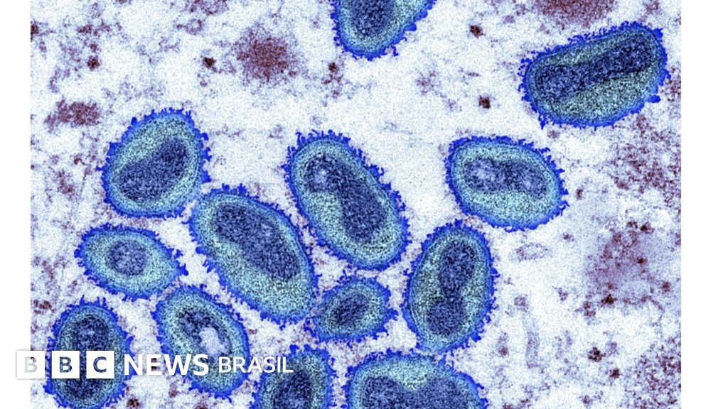 Varíola dos macacos: o que se sabe sobre a mortalidade da doença - BBC ...