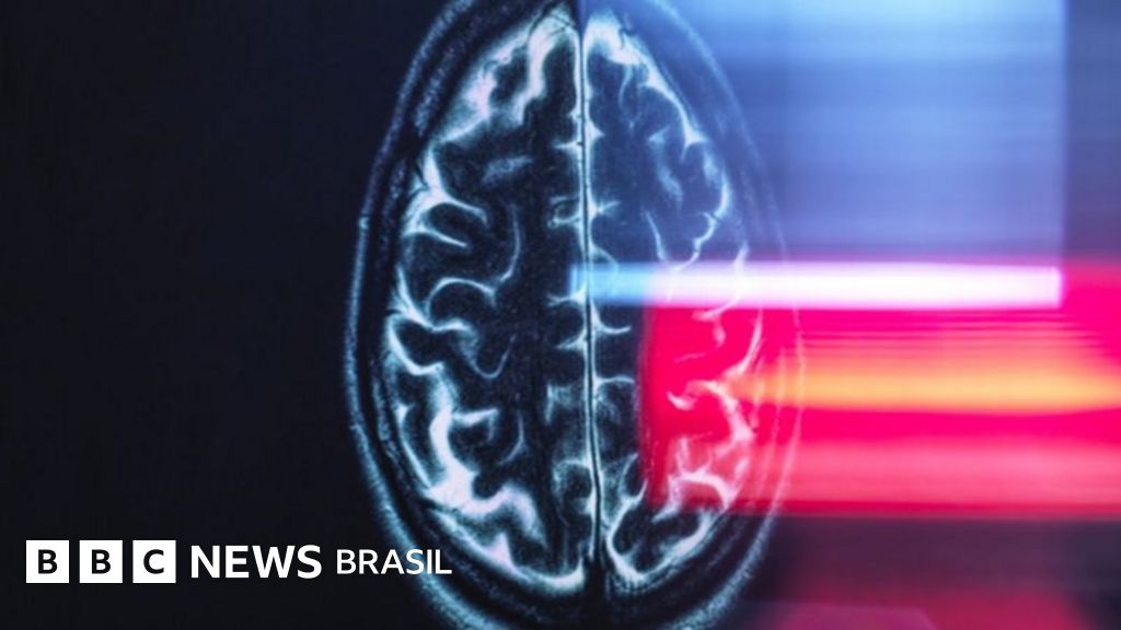 Por que Aristóteles achava que temos uma geladeira na cabeça – e outras curiosidades sobre o cérebro