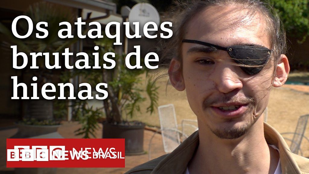 O tocante encontro entre jovens que foram desfigurados por hienas