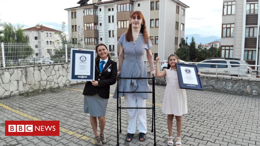 Rumeysa Gelgi A Mulher Mais Alta Do Mundo O Que A S Ndrome De Weaver Que A Deixou T O Alta