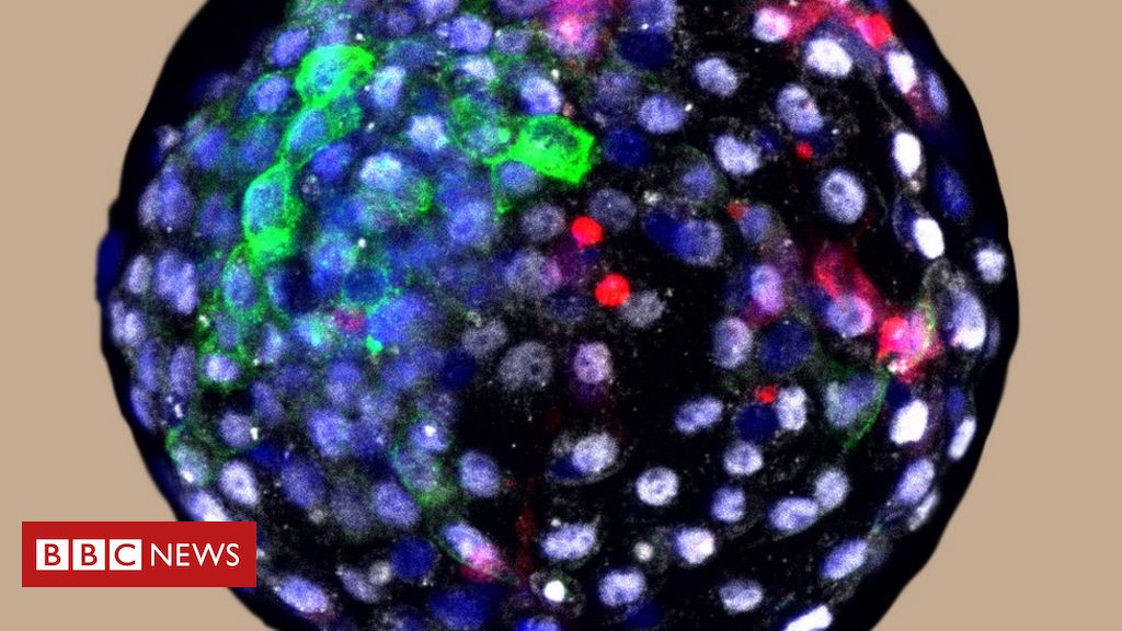O xeque-mate da ciência sobre as pesquisas com células-tronco - Blog da  Ciência