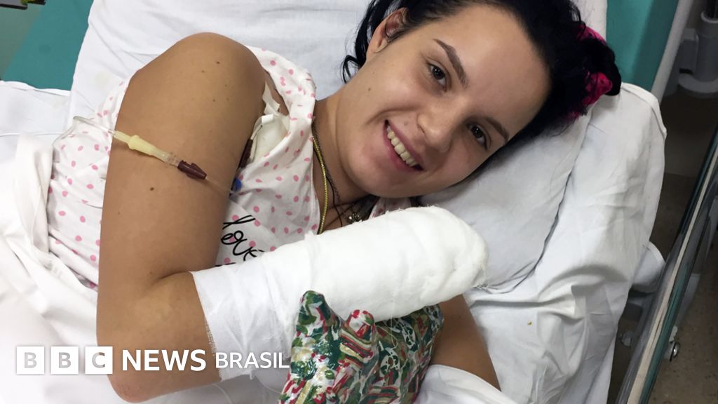 Rússia é condenada a pagar R$ 2,3 milhões a mulher que teve mãos cortadas pelo ex-marido
