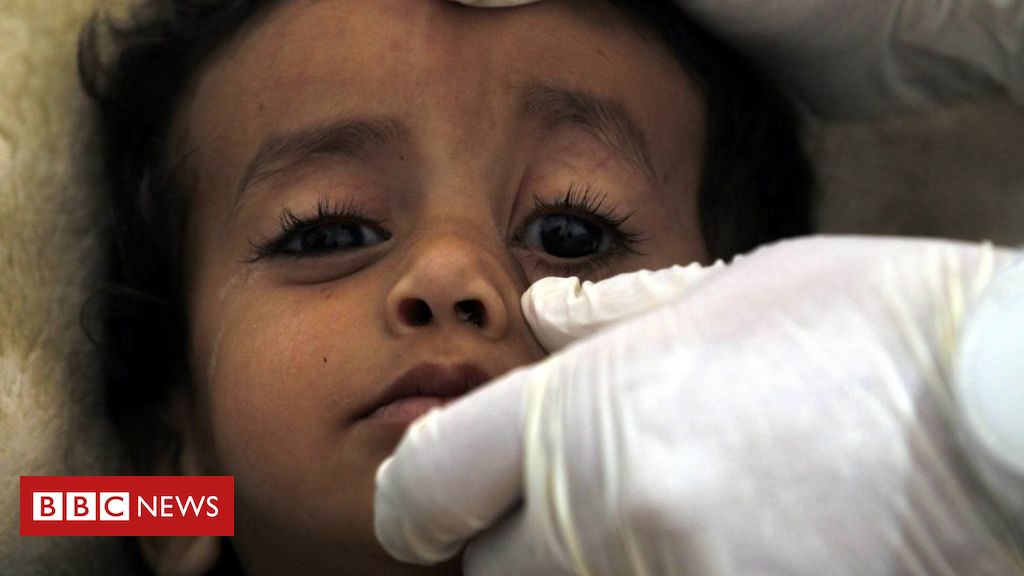 Surto de cólera agrava crise humanitária no Iêmen - BBC News Brasil