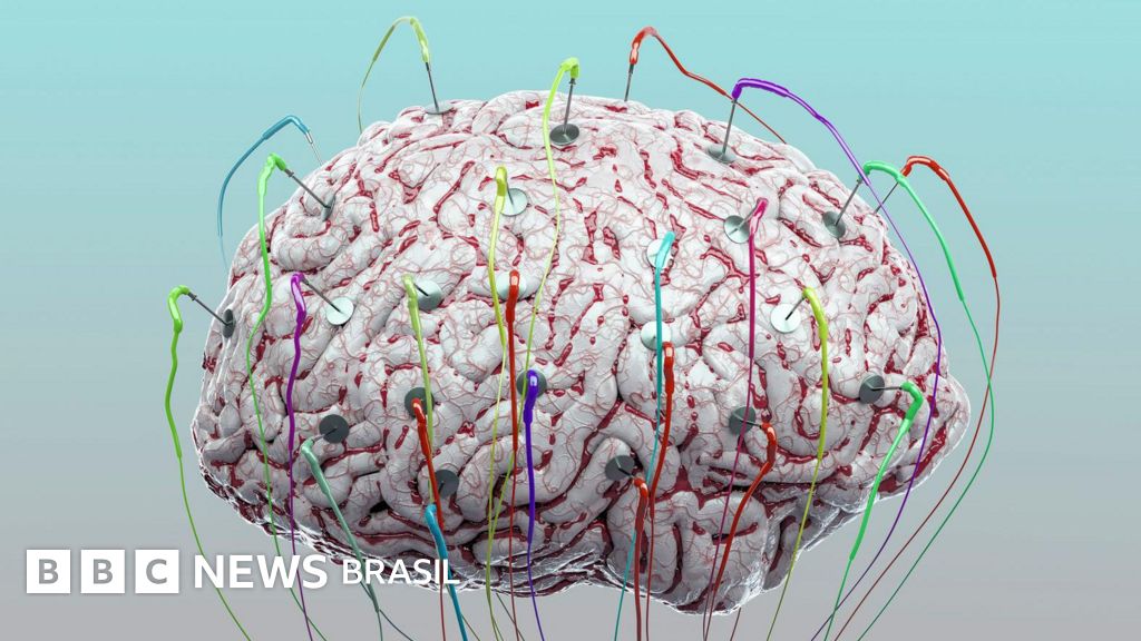 A tecnologia pode fazer cérebro funcionar melhor?