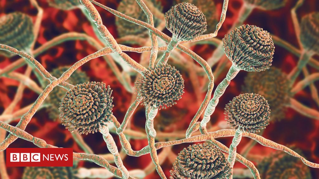 A epidemia mortal de infecção por fungo no cérebro que atinge a África