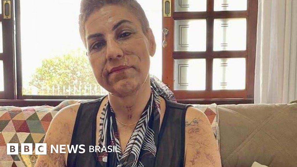 O que pode estar por trás do aumento de mortes por ataques de cães no Brasil