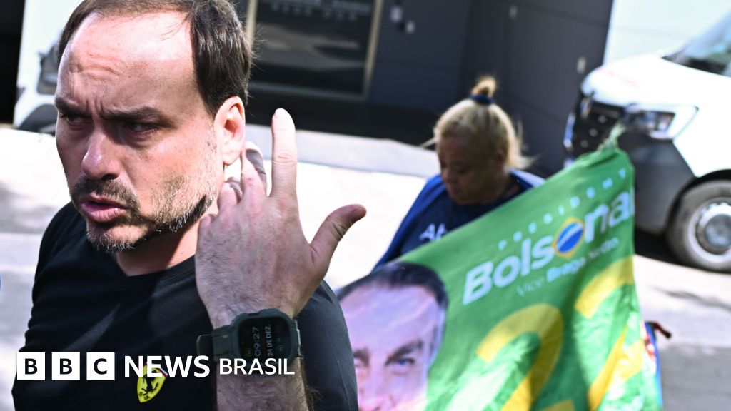 A nova intervenção médica planejada para deter as crises de soluço de Bolsonaro