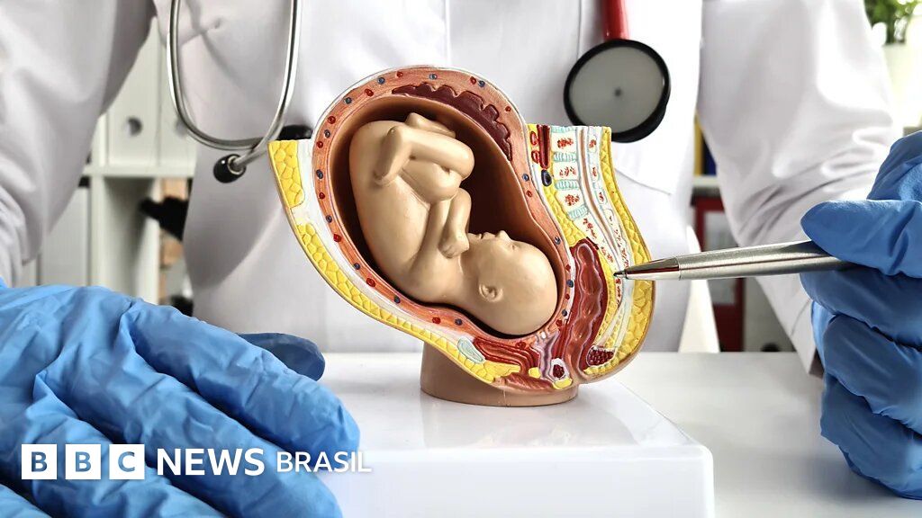 Como funcionam úteros artificiais que prometem salvar bebês muito prematuros (e quais os dilemas éticos disso)