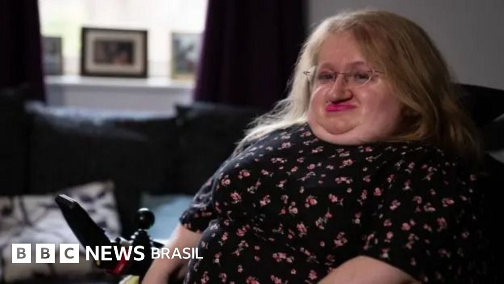 'Médico presumiu que eu não faço sexo porque tenho deficiência'