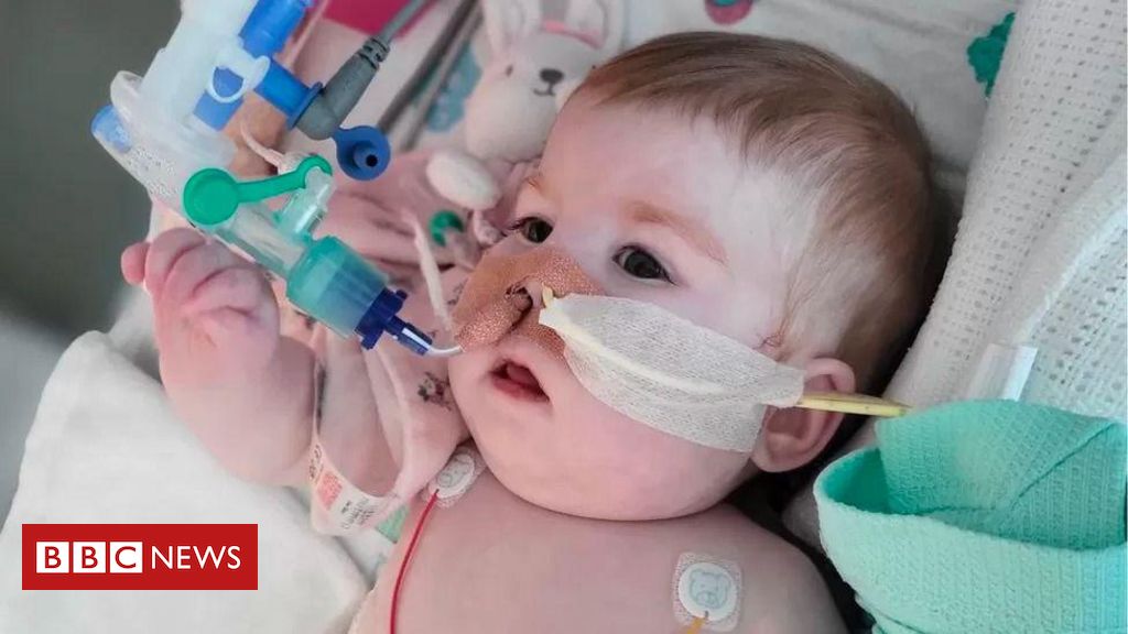 A seriously ill baby dies after being taken off life support in a legal battle