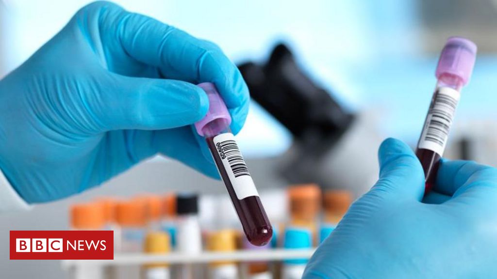 O exame de sangue em teste no Reino Unido que identifica mais de 50 tipos de câncer