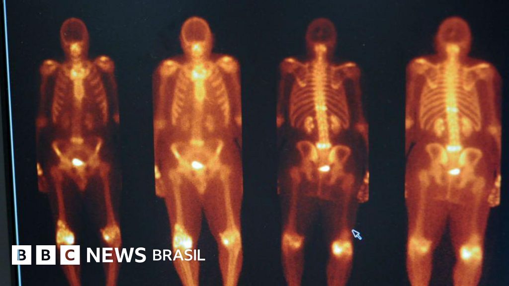 Tecnécio-99: o que é o material radiativo envolvido em incidente na USP e para que é usado