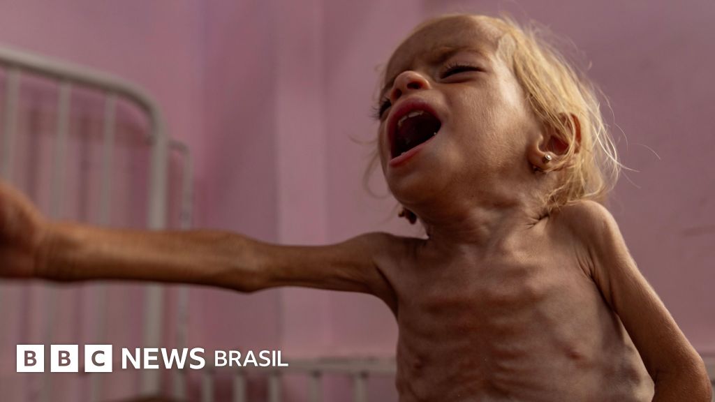 Fome é confirmada na Cidade de Gaza pela primeira vez, diz órgão ligado à ONU