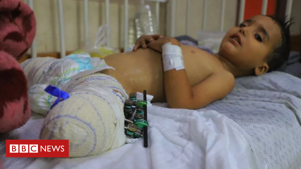 Criança ferida, família sem sobreviventes: a triste situação de centenas de crianças que ficaram órfãs em Gaza