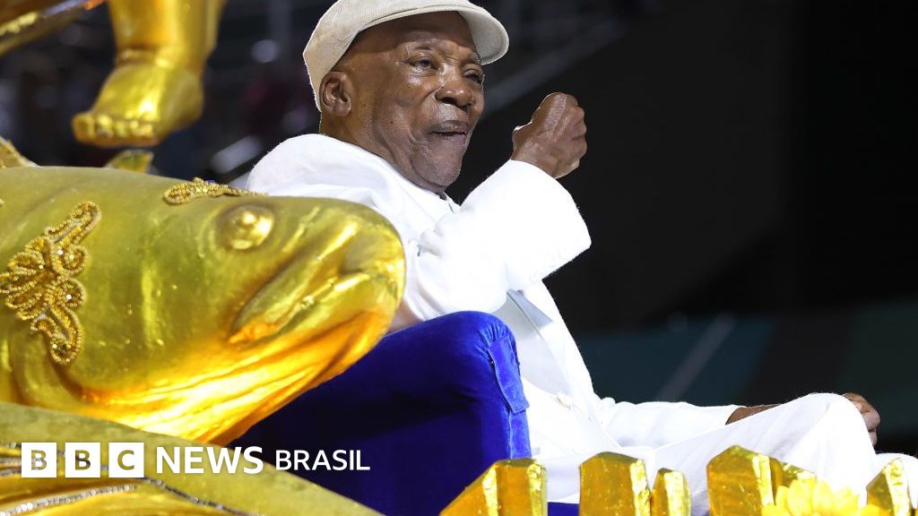 O que é a demência de corpos de Lewy, diagnosticada em Milton Nascimento