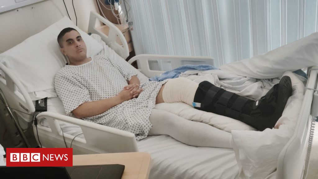 Mais um entregador brasileiro é atacado na Irlanda: 'Eles riam do meu desespero'