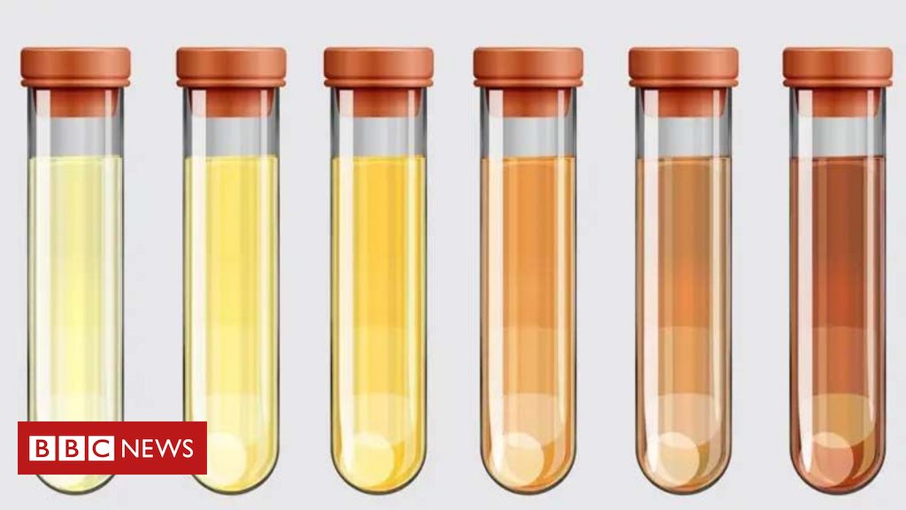 O que a cor do xixi revela sobre sua sade ou alimentao - BBC News Brasil