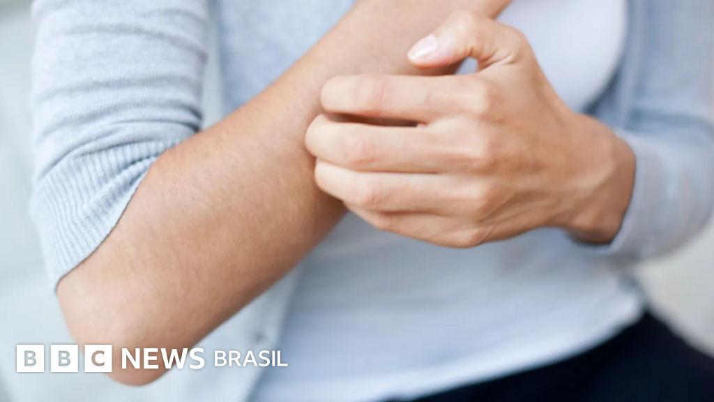 Por que a coceira dos outros causa repulsa