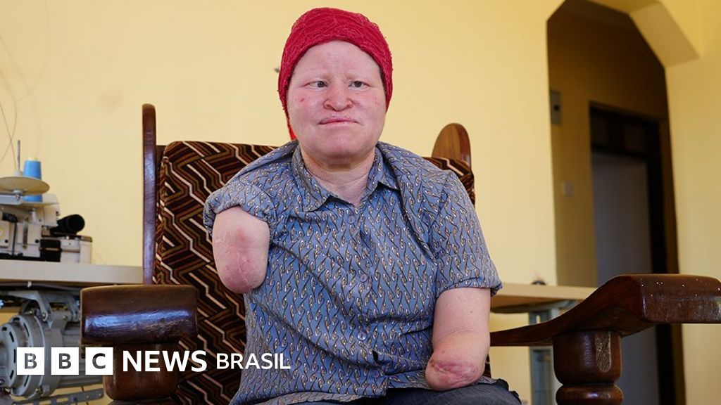 As pessoas com albinismo que viram alvo por superstição durante eleição: 'Muito medo'