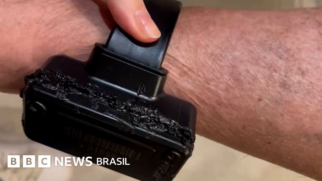 Bolsonaro diz que usou ferro de solda em tornozeleira