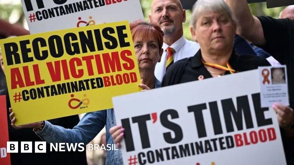 Como 30 mil pessoas pegaram HIV e hepatite C ao receber transfusões no Reino Unido