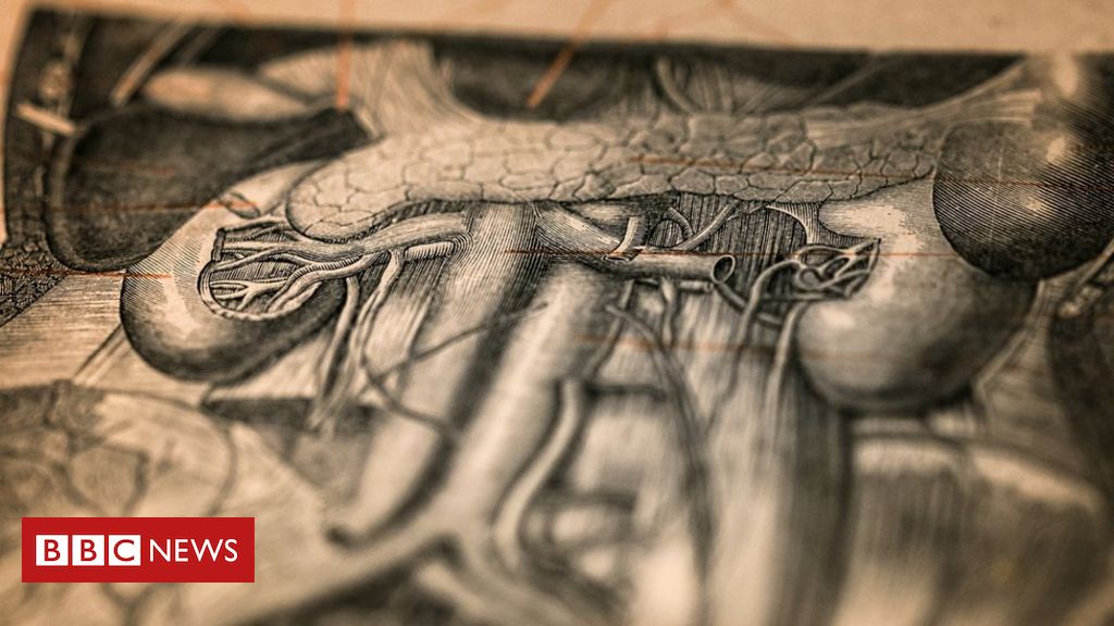 4 detalhes assustadores de como eram feitas as cirurgias dois séculos atrás  - BBC News Brasil